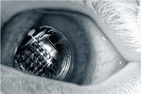 Cyborg Contact Lens